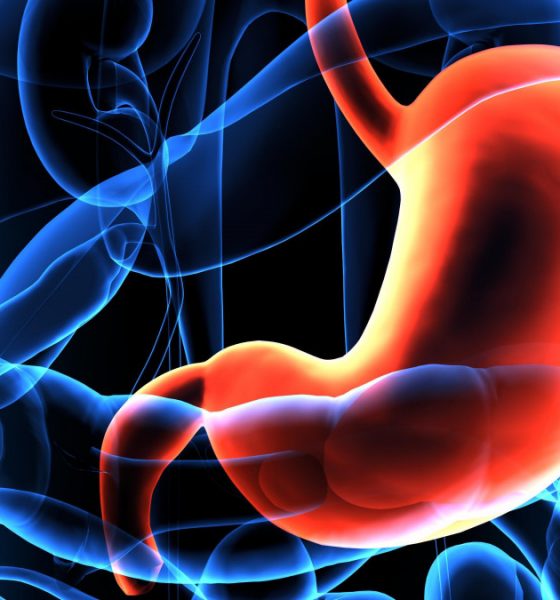 i89190-gastroplastie